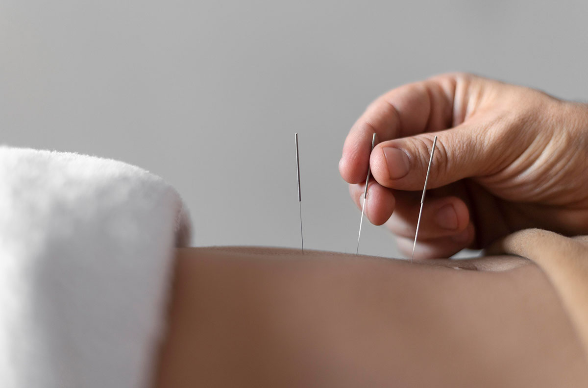 services-acupuncture-11012024