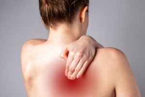 Myofascial Pain Syndrome