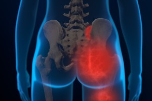 Sacroiliac Joint Dysfunction
